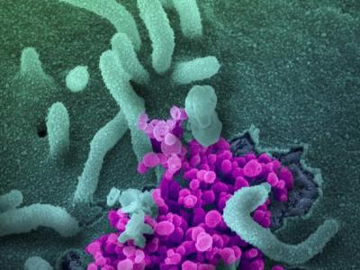 SARS-CoV-2 virus under microscope
