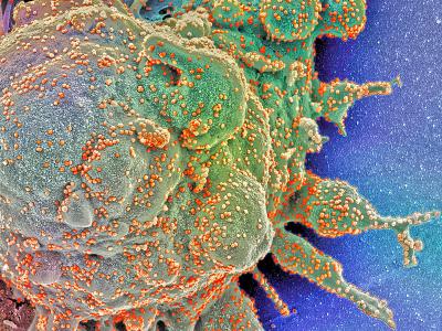 COVID cell attack