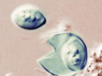 Rupturing Cyclospora oocyst viewed under microscope