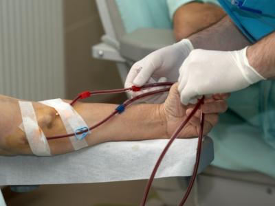 Dialysis