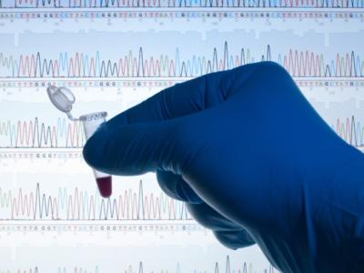 DNA test
