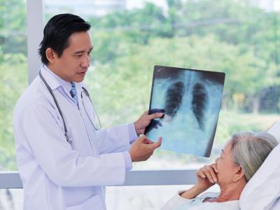 Doctor showing chest x-ray to patient