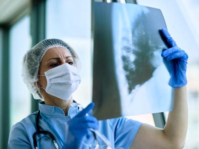 Doctor examining chest x-ray