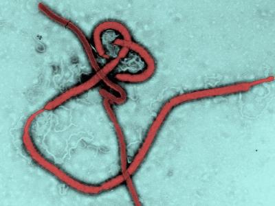 Ebola virus