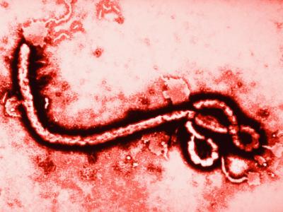 Ebola virus highly magnified