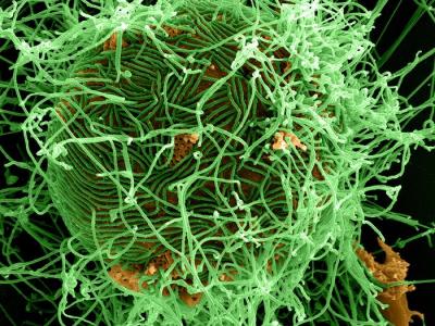 Ebola virus particles