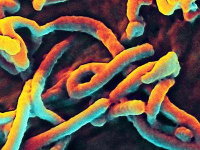 Ebola virus