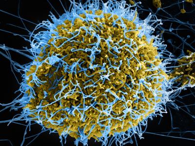 Ebola virus