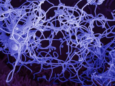 Ebola virus