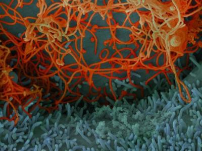 Ebola viruses