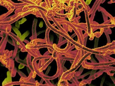 Ebola virus