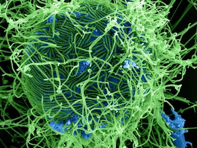 Ebola virus particles