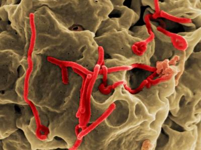 Ebola virus particles