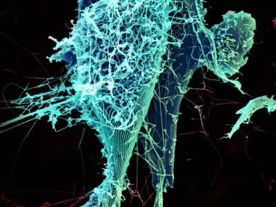 Ebola virus particles