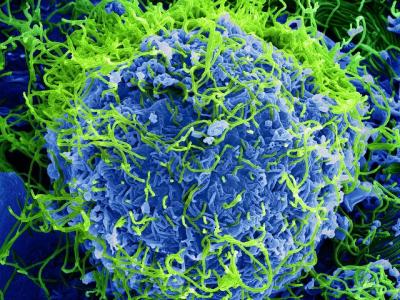 Ebola virus particles