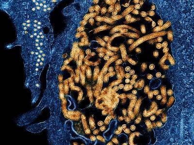 Ebola viruses