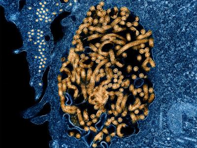 Ebola virus