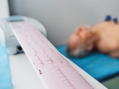 ECG printout and man with electrodes