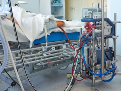 ECMO machine