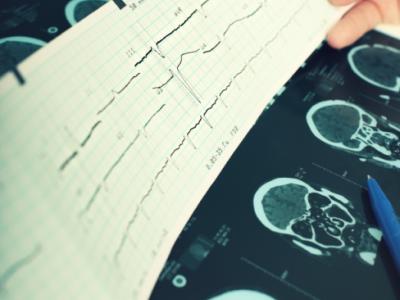 EEG readout