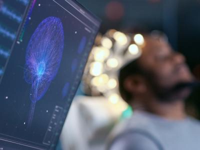 EEG brain monitoring