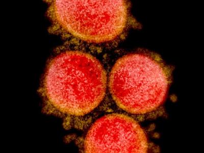 SARS-CoV-2 COVID-19 virus, highly magnified