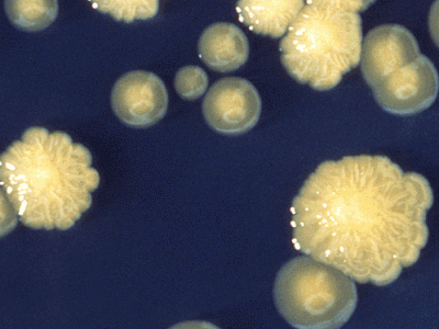 Enterobacter cloacae