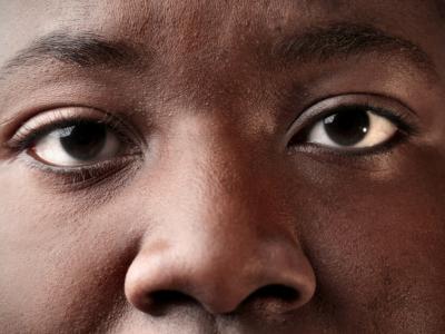 eyes
