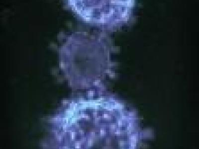 MERS-CoV micrograph