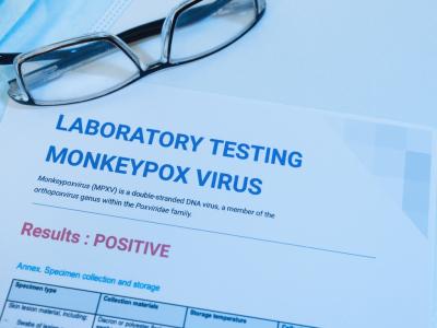 Paperwork showing positive monkeypox test results