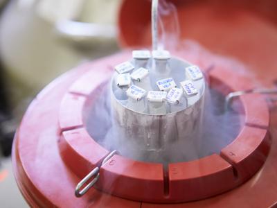 Sperm bank frozen storage