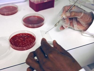 Scientist performing Gram staining in lab