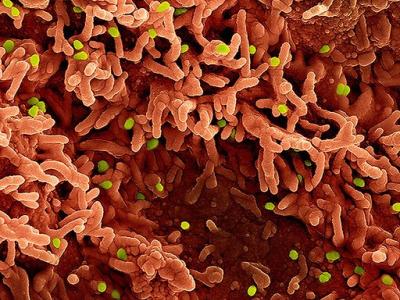 Green monkeypox viruses infecting red cells