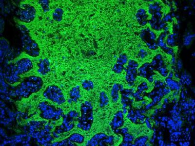 Gut bacteria