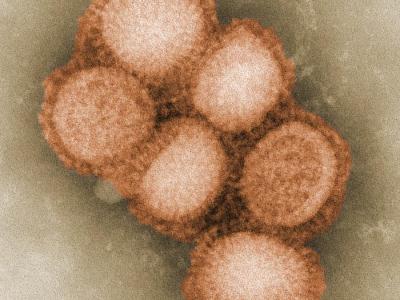 H1N1 virus