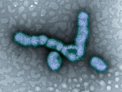 H1N1 influenza