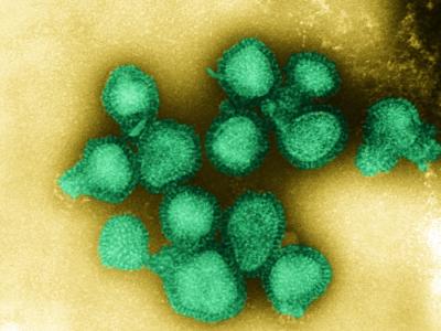 H3N2 virus