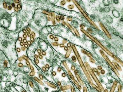 H5N1 under a microscope