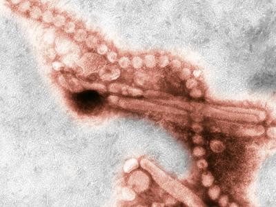Influenza A H7N9 as viewed through an electron microscope. Both filaments and spheres are observed in this photo.