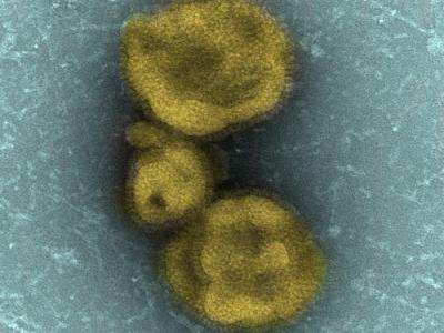 H7N9 virus