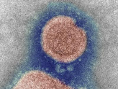 H7N9 micrograph image