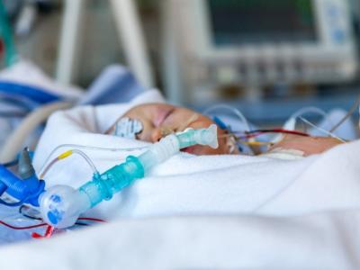 ICU baby