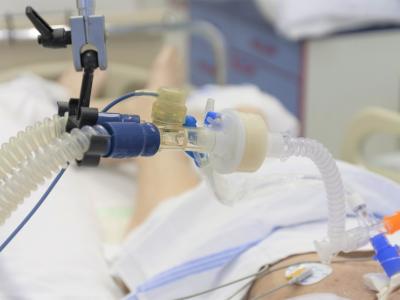ICU patient on ventilator