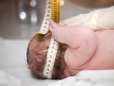 Infant head circumference
