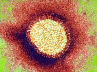 Influenza virus