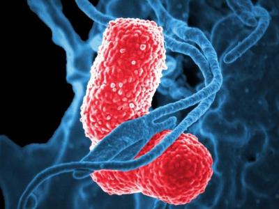 Klebsiella pneumoniae