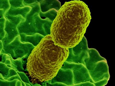 Klebsiella pneumoniae