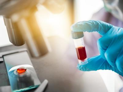 Lab blood testing