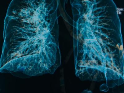 Lung imaging