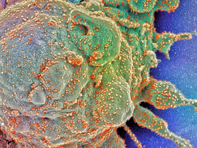 COVID-19 viruses under microscope